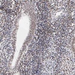 PBX1 Antibody, Novus Biologicals 25 &mu;L | Buy Online | Novus Biologicals | Fisher Scientific