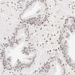 PBX1 Antibody, Novus Biologicals 25 &mu;L | Buy Online | Novus Biologicals | Fisher Scientific