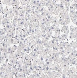 PBX1 Antibody, Novus Biologicals 25 &mu;L | Buy Online | Novus Biologicals | Fisher Scientific