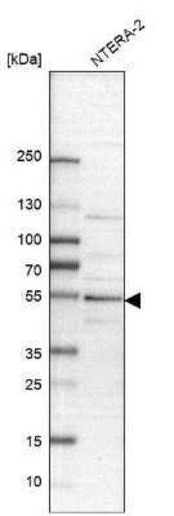 PBX1 Antibody, Novus Biologicals 25 &mu;L | Buy Online | Novus Biologicals | Fisher Scientific