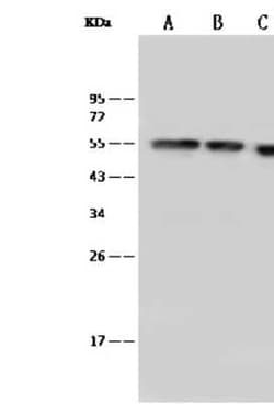 PBX1 Antibody, Novus Biologicals 100 &mu;g; Unconjugated:Antibodies, Polyclonal