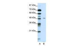 PBX2 Rabbit anti-Human, Mouse, Polyclonal, Novus Biologicals 0.1ml; Unconjugated:Antibodies,