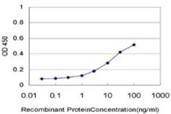 Novus Biologicals PCAF Antibody (2B4), Novus Biologicals 0.1 mg | Buy Online | Novus Biologicals&trade; | Fisher Scientific