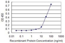 Novus Biologicals PCAF Antibody (5E8), Novus Biologicals 0.1 mg | Buy Online | Novus Biologicals&trade; | Fisher Scientific