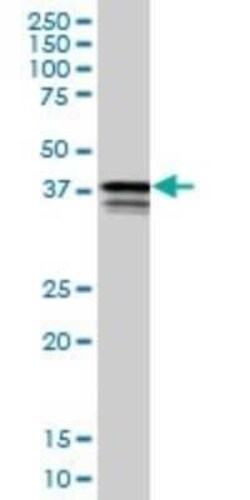PCBP2 Antibody (1B6), Novus Biologicals 0.1 mg | Buy Online | Novus Biologicals | Fisher Scientific