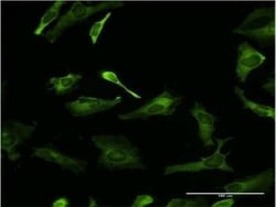 PCBP2 Antibody (3A1), Novus Biologicals 0.1 mg | Buy Online | Novus Biologicals | Fisher Scientific