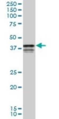 PCBP2 Antibody (3A1), Novus Biologicals 0.1 mg | Buy Online | Novus Biologicals | Fisher Scientific