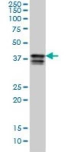PCBP2 Antibody (5F12), Novus Biologicals 0.1 mg | Buy Online | Novus Biologicals | Fisher Scientific