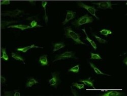 PCBP2 Antibody (6E9), Novus Biologicals 0.1 mg | Buy Online | Novus Biologicals | Fisher Scientific