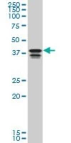 PCBP2 Antibody (6E9), Novus Biologicals 0.1 mg | Buy Online | Novus Biologicals | Fisher Scientific