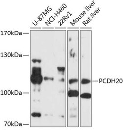 PCDH20 Antibody - BSA Free, Novus Biologicals 0.02 mL, Unconjugated:Antibodies,
