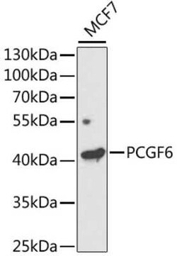 PCGF6 Antibody - Azide and BSA Free, Novus Biologicals 0.1 mL, Unconjugated:Antibodies,