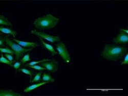 PCID2 Antibody, Novus Biologicals 0.1 mg | Buy Online | Novus Biologicals | Fisher Scientific
