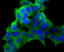 PCK1 Antibody (JU84-39), Novus Biologicals 100 &mu;l; Unconjugated:Antibodies,