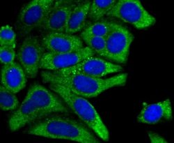 PCK1 Antibody (JU84-39), Novus Biologicals 100 &mu;l; Unconjugated:Antibodies,