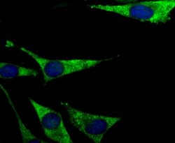 PCK1 Antibody (JU84-39), Novus Biologicals 100 &mu;l; Unconjugated:Antibodies,