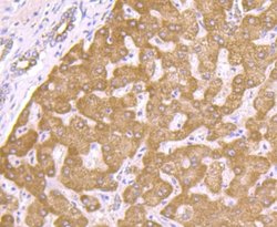 PCK1 Antibody (JU84-39), Novus Biologicals 100 &mu;l; Unconjugated:Antibodies,
