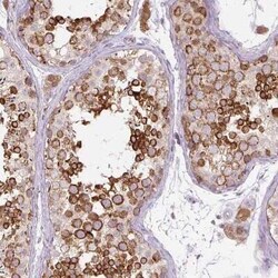 PCM1 Antibody (CL0206), Novus Biologicals 25 &mu;L, Unconjugated:Antibodies,