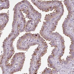 PCM1 Antibody (CL0206), Novus Biologicals 25 &mu;L, Unconjugated:Antibodies,