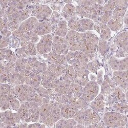 PCM1 Antibody (CL0206), Novus Biologicals 25 &mu;L, Unconjugated:Antibodies,