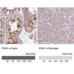 PCM1 Antibody (CL0206), Novus Biologicals 25 &mu;L, Unconjugated:Antibodies,