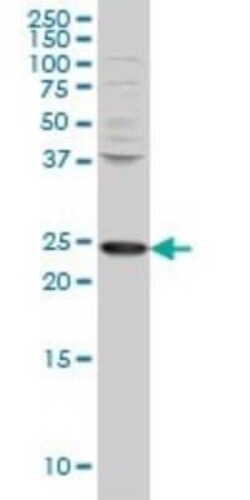 PCMT1 Antibody (1D6), Novus Biologicals 0.1 mg | Buy Online | Novus Biologicals | Fisher Scientific