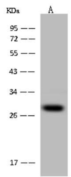 PCMT1 Antibody, Novus Biologicals 50 &mu;g, Unconjugated:Antibodies, Polyclonal