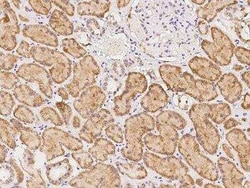 PCMTD2 Antibody, Novus Biologicals 100 &mu;g; Unconjugated:Antibodies,