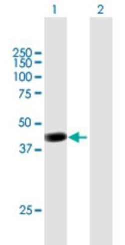 PCMTD2 Antibody, Novus Biologicals 0.05 mg | Buy Online | Novus Biologicals | Fisher Scientific
