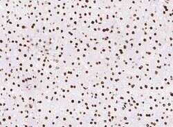 PCNA Rabbit anti-Human, Clone: 144, Novus Biologicals 50 &mu;g | Buy Online | Novus Biologicals | Fisher Scientific