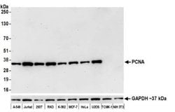 PCNA Antibody (BLR075G), Novus Biologicals 100 &mu;L | Buy Online | Novus Biologicals | Fisher Scientific