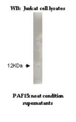 PCNA associated factor Antibody (K11-P1G7 B8) - BSA Free, Novus Biologicals:Antibodies:Primary