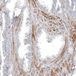 PCP4 Antibody (CL5306), Novus Biologicals 25 &mu;L:Antibodies, Monoclonal
