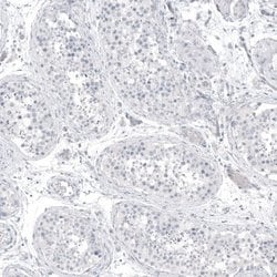 PCP4 Antibody (CL5306), Novus Biologicals 25 &mu;L:Antibodies, Monoclonal