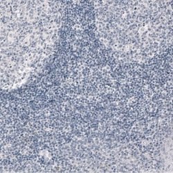 PCP4 Antibody (CL5306), Novus Biologicals 25 &mu;L:Antibodies, Monoclonal