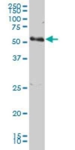 PCTAIRE1 Antibody (2E5), Novus Biologicals 0.1 mg | Buy Online | Novus Biologicals | Fisher Scientific