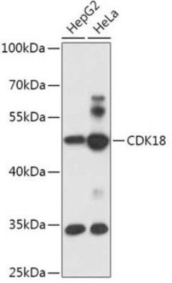 PCTAIRE3 Antibody - Azide and BSA Free, Novus Biologicals 0.02 mL; Unconjugated:Antibodies,