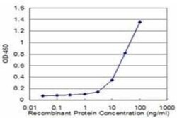 PCYT1A Antibody (6E6), Novus Biologicals 0.1 mg | Buy Online | Novus Biologicals | Fisher Scientific