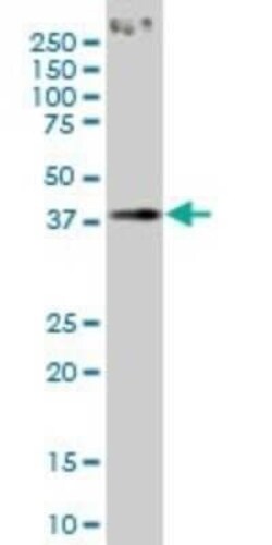 PCYT1A Antibody (6E6), Novus Biologicals 0.1 mg | Buy Online | Novus Biologicals | Fisher Scientific