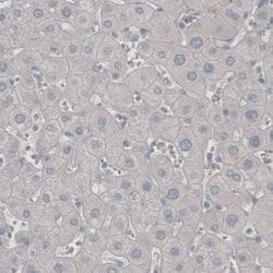 PD-1 Antibody (CL3624), Novus Biologicals 25 &mu;L:Antibodies, Monoclonal
