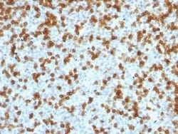 PD-1 Antibody (PDCD1/1410R), Novus Biologicals:Antibodies:Primary Antibodies