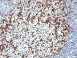 PD-1 Antibody (PDCD1/922), Novus Biologicals:Antibodies:Primary Antibodies