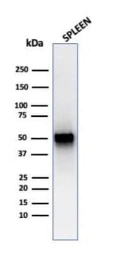 PD-ECGF/Thymidine Phosphorylase Mouse anti-Human, Mouse, Rat, Clone: rTYMP/3444,