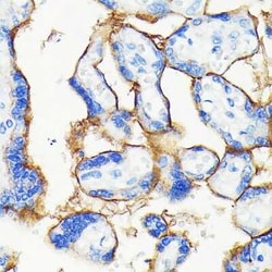 PD-L1 Rabbit anti-Human, Mouse, Rat, Clone: 1T10L4, Novus Biologicals 100