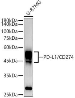 PD-L1 Rabbit anti-Human, Mouse, Rat, Clone: 1T10L4, Novus Biologicals 100