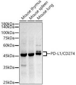 PD-L1 Rabbit anti-Human, Mouse, Rat, Clone: 1T10L4, Novus Biologicals 100