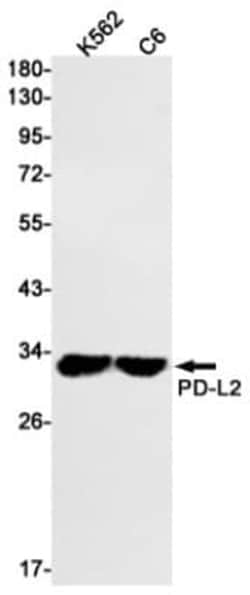 PD-L2/B7-DC/PDCD1LG2 Antibody (S02-2A1), Novus Biologicals 50 &mu;g; Unconjugated:Antibodies,