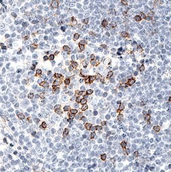 Human PD-1 Antibody, R D Systems 25 &mu;g | Buy Online | R&D Systems | Fisher Scientific