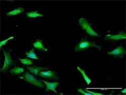 PDCD2 Antibody, Novus Biologicals 0.1 mg | Buy Online | Novus Biologicals | Fisher Scientific