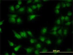 PDCD2L Antibody (5F9), Novus Biologicals 0.1 mg | Buy Online | Novus Biologicals | Fisher Scientific